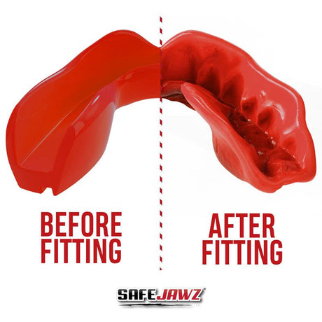 Protetor bucal Safejawz Intro Series – Vermelho