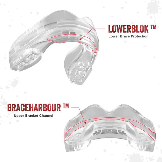 Safejawz Protector bucal para brackets - Transparente - Protectores bucales